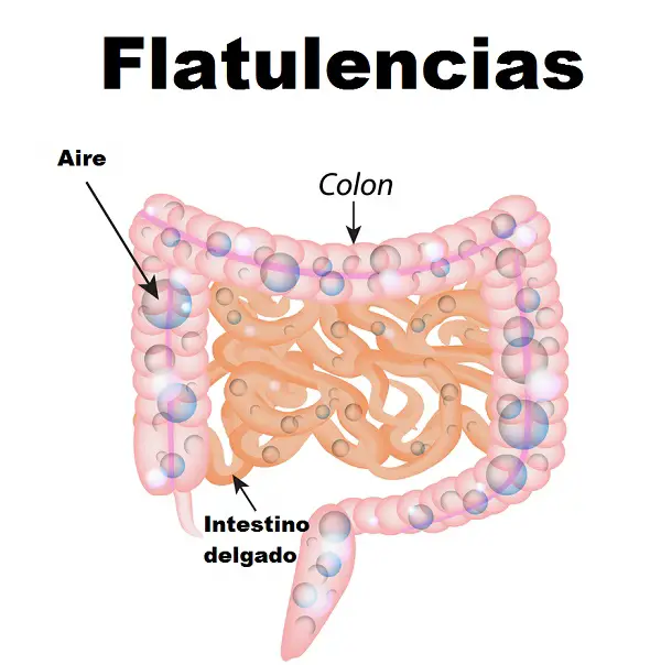 flatulencias