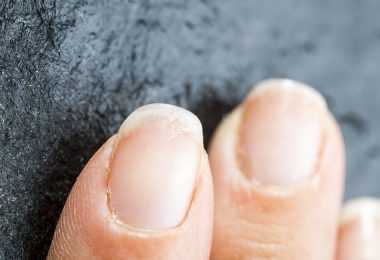 Mujer con uñas débiles y maltratadas