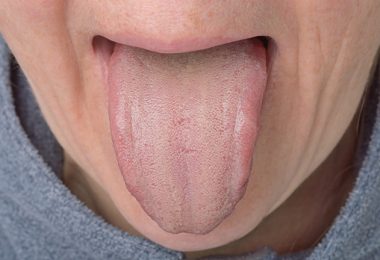 Hombre joven con lengua blanca y problemas estomacales