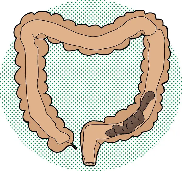 dieta vegetariana hace los movimientos de intestinos más regulares