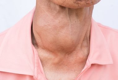 Conoce las causas del hipertiroidismo