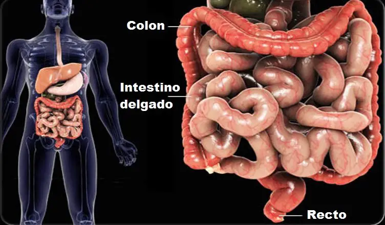 intestino enfermo