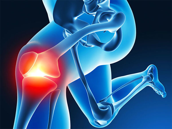Dolor en articulación cuando hay deficiencia de calcio