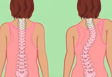 como elegir un buen colchón si tienes escoliosis
