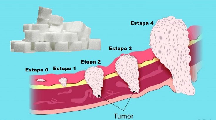 células cancerosas etapas