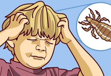 niño con piojos en la cabeza ilustración