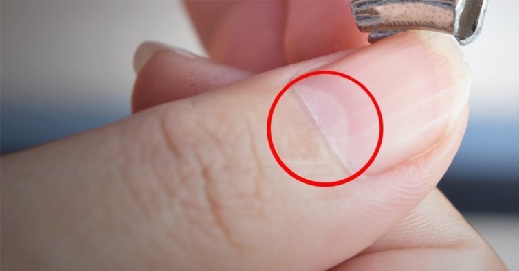 lunula revela problemas de salud
