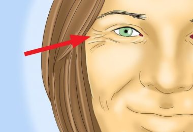 Los diferentes tipos de arrugas en la piel de las mujeres