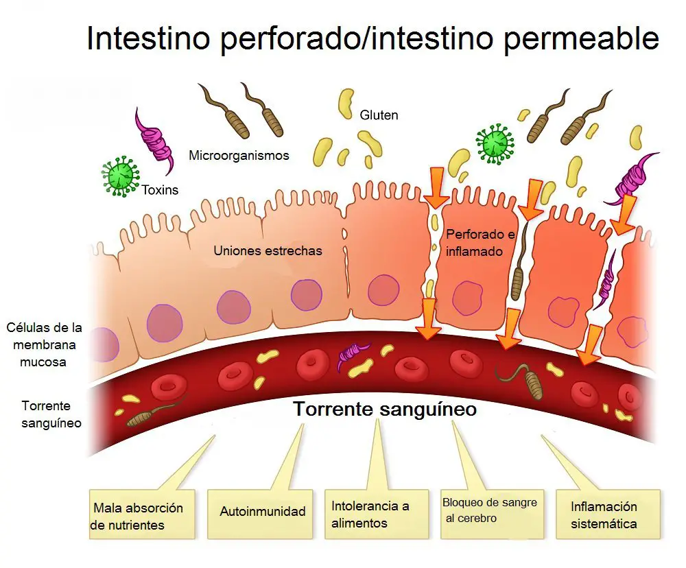 deficiencias de nutrientes intestino perforado