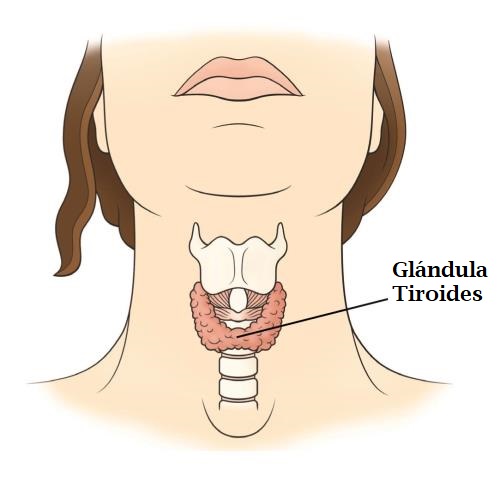 tiroiditis de hashimoto ilustración