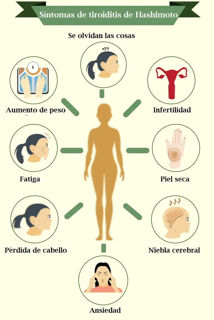 tiroiditis de hashimoto síntomas