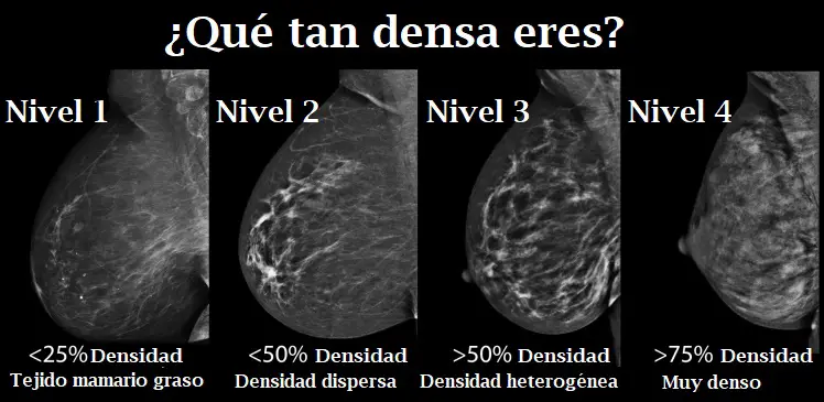 mamografías densidad de senos