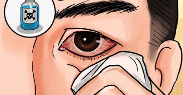 hombre que padece conjuntivitis