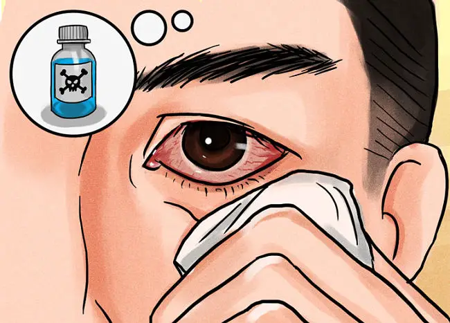 hombre que padece conjuntivitis