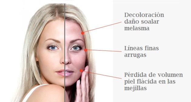 peau du visage à 30 ans