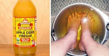 beneficios de sumergir los pies en vinagre de manzana