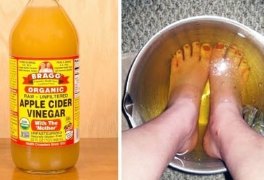 beneficios de sumergir los pies en vinagre de manzana