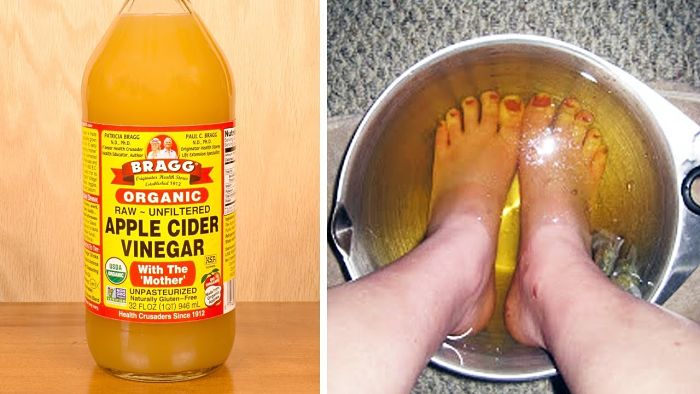 beneficios de sumergir los pies en vinagre de manzana