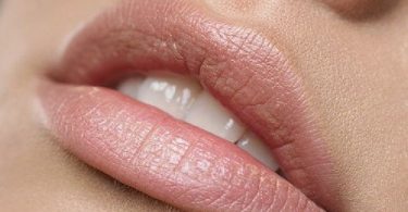 labios que antes tenían manchas y ahora se ven perfectos