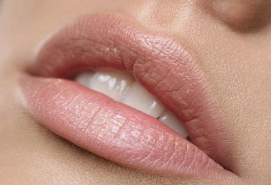 labios que antes tenían manchas y ahora se ven perfectos