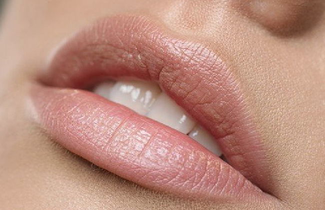 labios que antes tenían manchas y ahora se ven perfectos