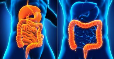 Conoce las causas y síntomas de la colitis ulcerosa