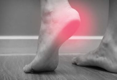 Las causas del dolor de talón y cómo tratarlo