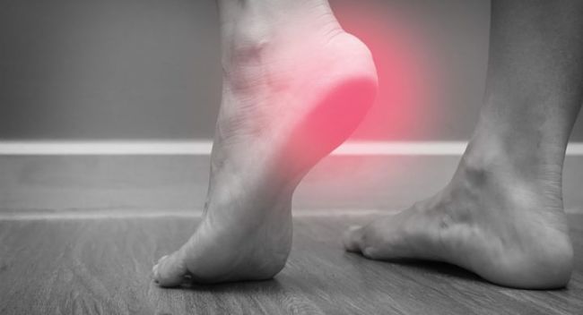 Las causas del dolor de talón y cómo tratarlo