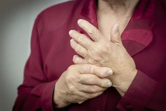 diferencias entre la artritis y la artrosis