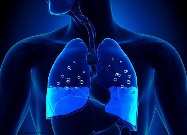Síntomas del edema pulmonar y cuáles pueden ser sus causas