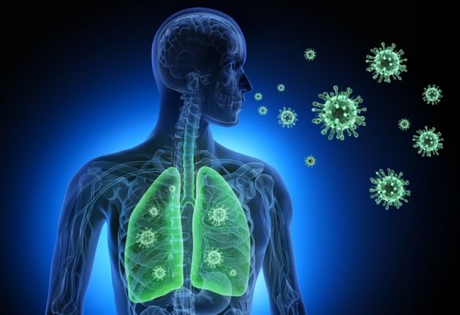 Síntomas de la neumonía y cómo puede afectar la salud