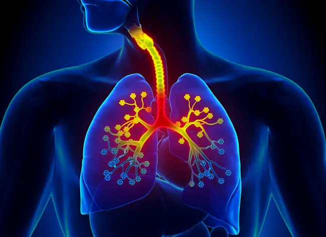 Sintomas de inflamación de las vías respiratorias por bronquitis aguda