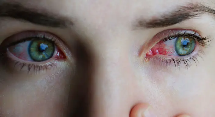 Causas de dolor ocular y cómo tratarlo