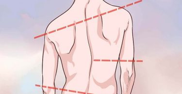 Cuáles son los síntomas y causas de la escoliosis