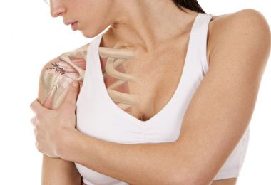 Cómo se puede tratar la tendinitis en el hombro