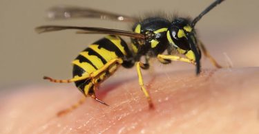 Una avispa picando el cuerpo de una persona