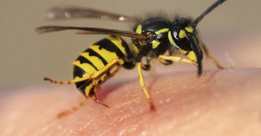 Una avispa picando el cuerpo de una persona