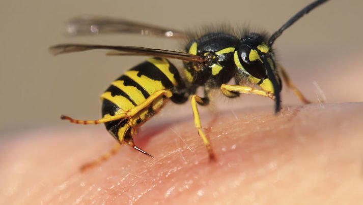 Una avispa picando el cuerpo de una persona