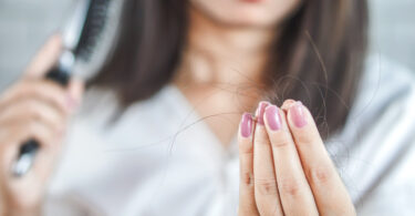 Mujer que sufre de caída del cabello