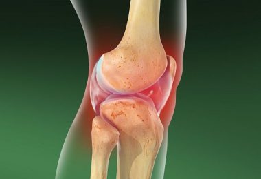 Ejercicio para tratar artrosis de rodilla