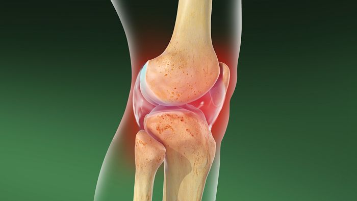 Ejercicio para tratar artrosis de rodilla