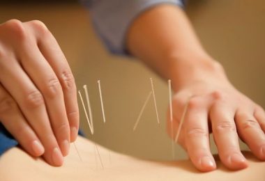 mujer haciendo acupuntura