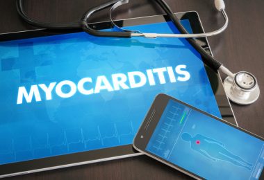 Causas de la miocarditis