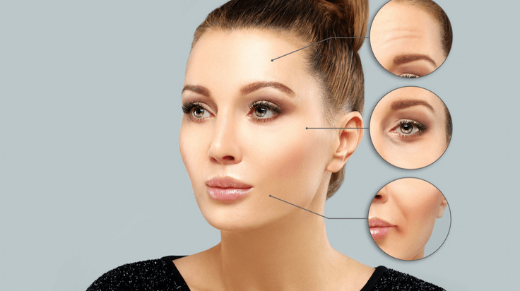 efectos secundarios del botox