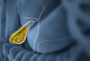 Dieta para tratar la vesícula biliar