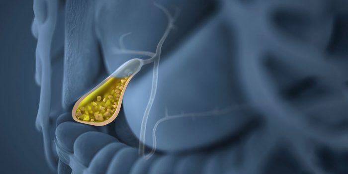 Dieta para tratar la vesícula biliar