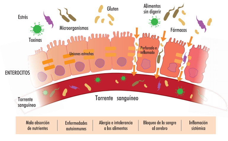 intestino permeable