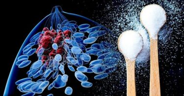 Azúcar y desarrollo del cáncer