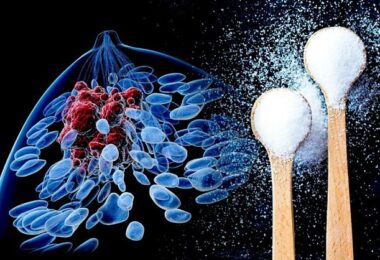 Azúcar y desarrollo del cáncer