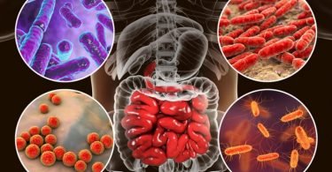 Relación entre intestino permeable y aumento de peso